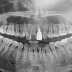 矯正歯科治療の検査と診断
